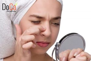 Xông mặt trị mụn đúng cách